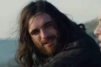 Джейкоб Элорди рассказал об ожоге второй степени